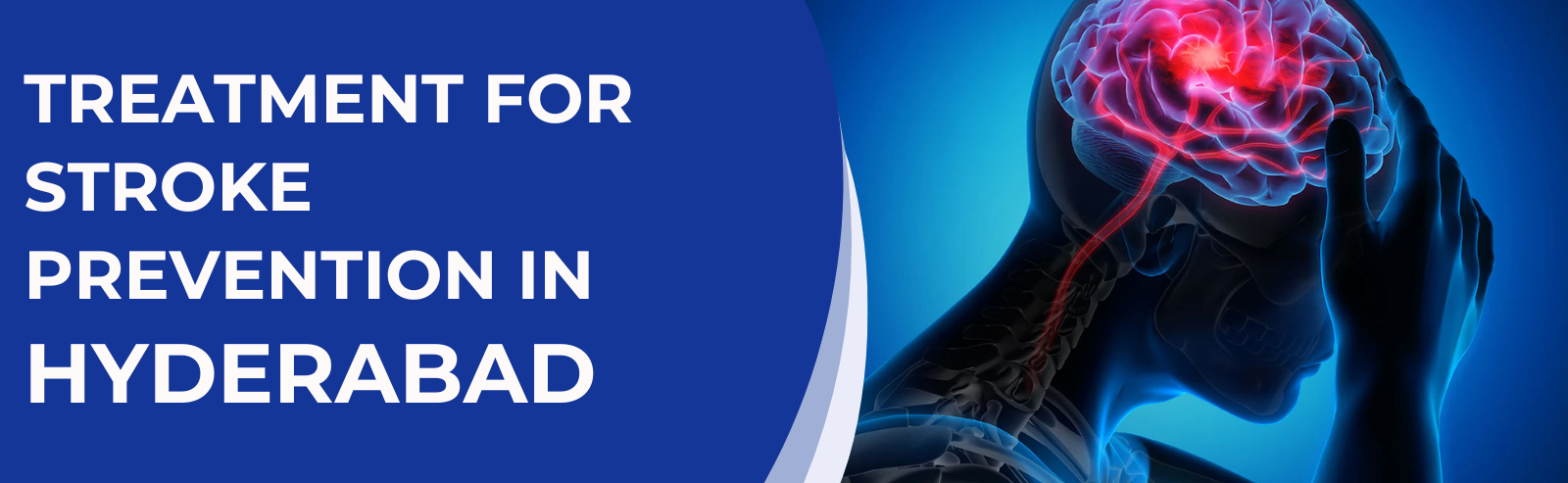 Best AV Fistula Surgery in Hyderabad